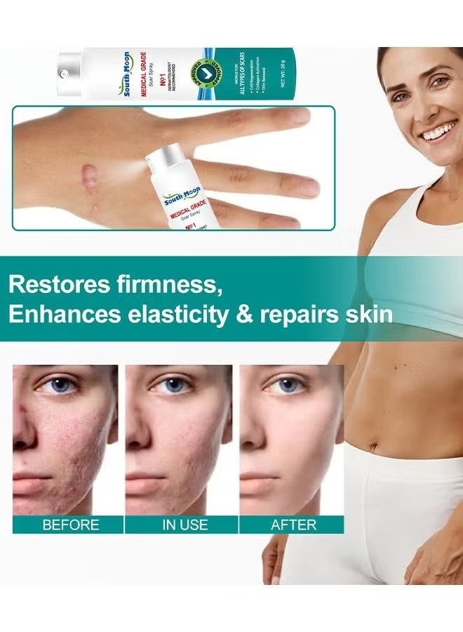 SOUTH MOON Scar Care Spray Burns Scars Stretch Marks Fade Scars Smooth Skin 20G - Image 5